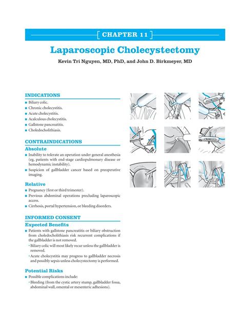 Ch. 11: Laparoscopic Cholecystectomy