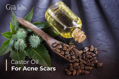 Castor Oil for Acne Scars: Your Ultimate Solution for Flawless Skin