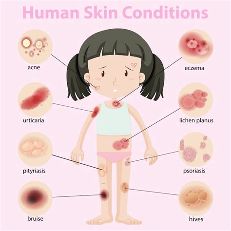 Free Vector | Diagram showing human skin conditions