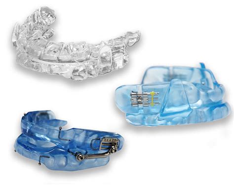 Oral Appliances, Effective CPAP Alternatives for Sleep Apnea | Ohio ...