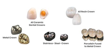 Same Day Crowns - Easy, Convenient and Hassle-free