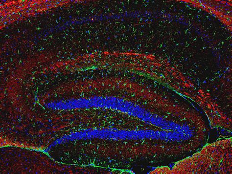 Neuronal-astrocytic network of the mouse hippocampus