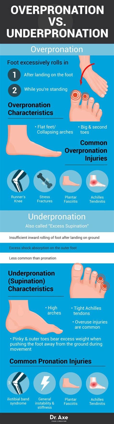 Pronation Problems: Signs, Causes & Ways to Correct Pronation deviations that occur at the feet ...