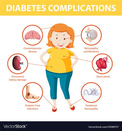 Diabetes complications information infographic Vector Image