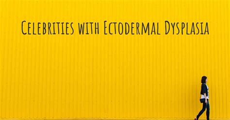 Celebrities with Ectodermal Dysplasia