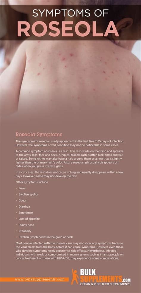 Roseola: Symptoms, Causes & Treatment