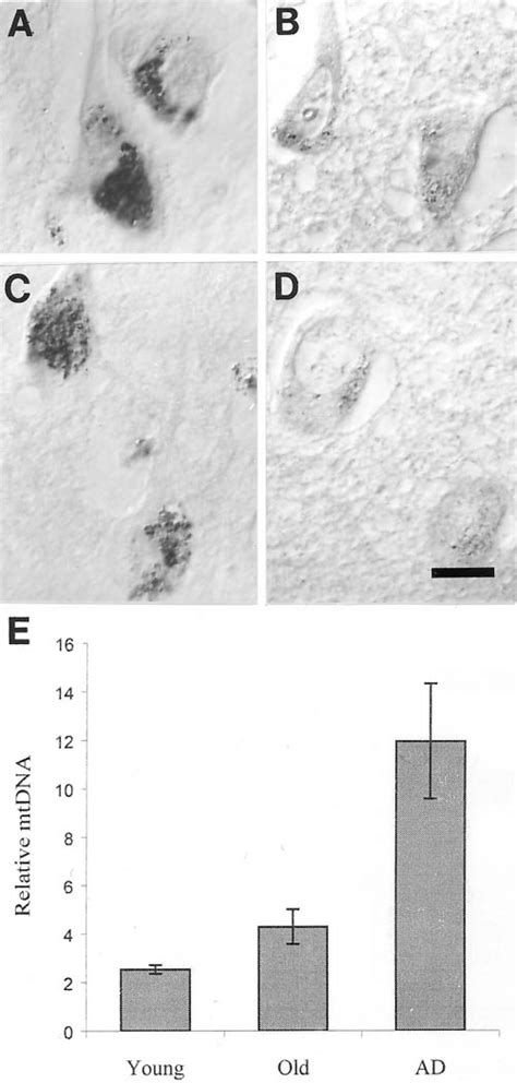 Pyramidal neurons of the hippocampus, cells highly vulnerable to death ...