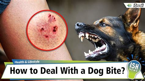 Why Do I Need A Tetanus Shot After A Dog Bite: Vital Information