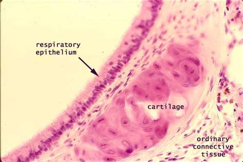 Tracheal Cartilage Histology