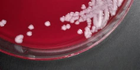 FDA approves expanded use of Emergent BioSolution's anthrax vaccine | Fox News