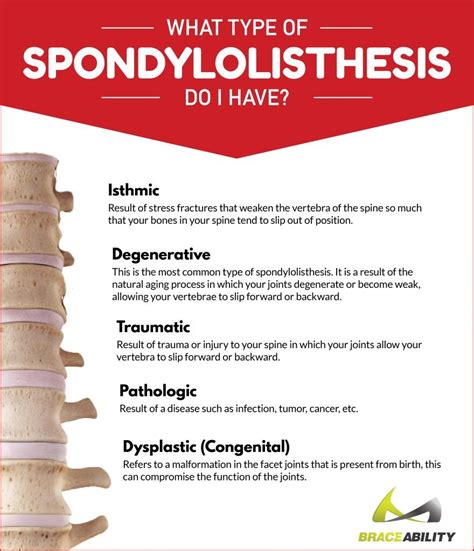 What Are Common Symptoms & Causes of Spondylolisthesis?