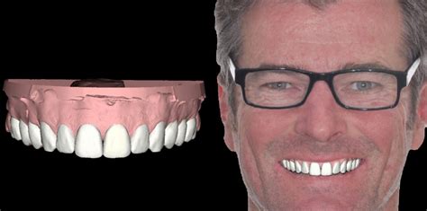 Digital Smile Design: Transforming Dentistry | Verve Magazine