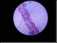 Histology Slides Database: Chronic Cholecystitis High Resolution ...