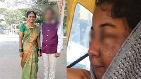 Karnataka bride's face disfigured after makeup, beautician detained for questioning - KalingaTV