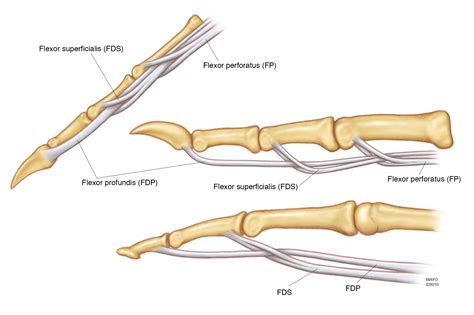 Tendon Diagram Of Hand : Wrist injuries - EMCAGE : Tendon repair of the hand is surgery to ...