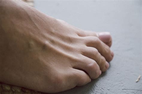 How To Fix A Dislocated Toe | Canyon Oaks Foot & Ankle | Visalia Podiatry