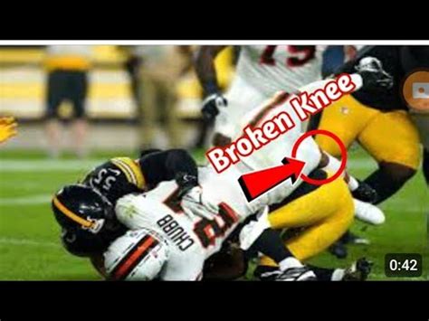 chubb injury full video