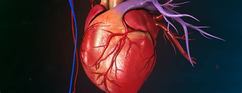 Cardiac Catheterization