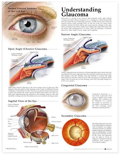 Understanding Glaucoma Chart | Family Nurse Practitioner | Pinterest ...