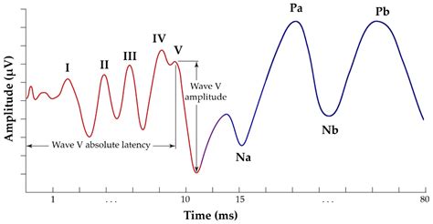 V-shaped perceptual sensitivity curves. Amplitude thresholds as a - kienitvc.ac.ke