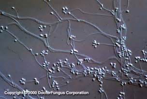 Sporothrix Species - Doctor Fungus