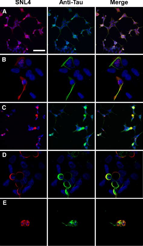 Tau Protein Measurement | Semantic Scholar