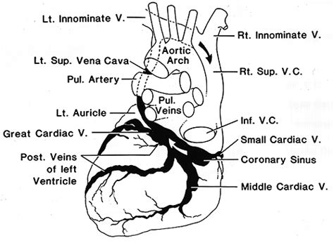 Coronary Sinus X Ray