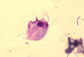 Trichomonas hominis trophozoite (no cyst stage) | Medical laboratory ...