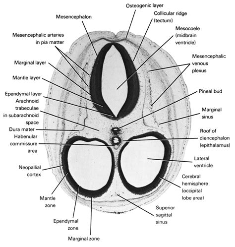 Atlas of Human Embryos Figure 8-3-1