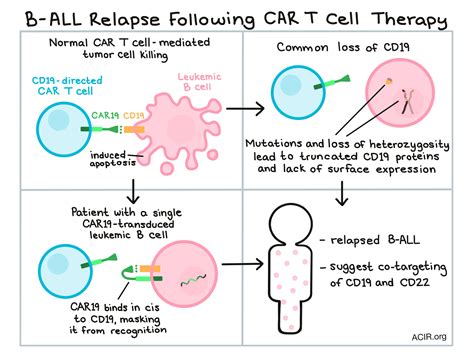 Mechanism Of Action Of Car T Cell Therapy Patient S T Cells Are | My ...