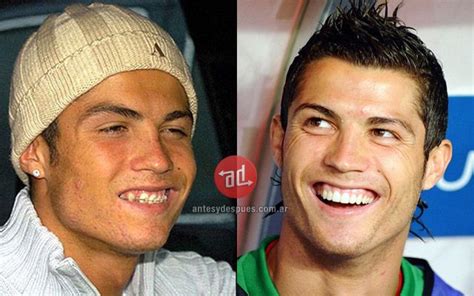 cristiano ronaldo 2002 teeth - Google Search | Bellezza