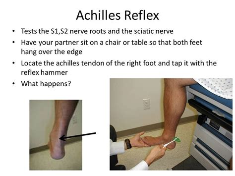 Achillies Reflex Test Sciatic Nerve, Reflexes, Physical Therapy ...