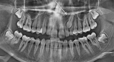 What is Oral Surgery - Hobart Orofacial Pain and Special Needs Clinic