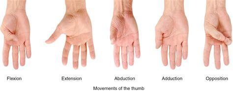 Thumb Arthritis - Causes, Symptoms, Exercises, Splint & Treatment