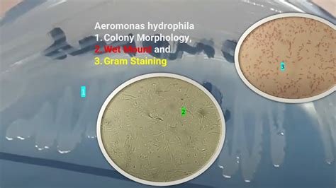 Aeromonas hydrophila Colony Morphology, Wet Mount and Gram Staining ...