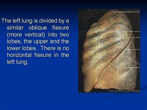 Lobes and fissures of lungs The right lung