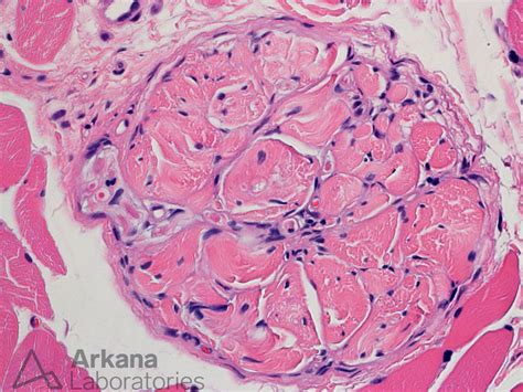 Golgi Tendon Organ | Neuro Notes | Arkana Laboratories