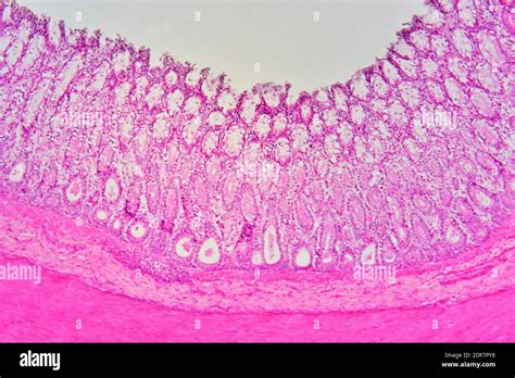 Vermiform Appendix Histology