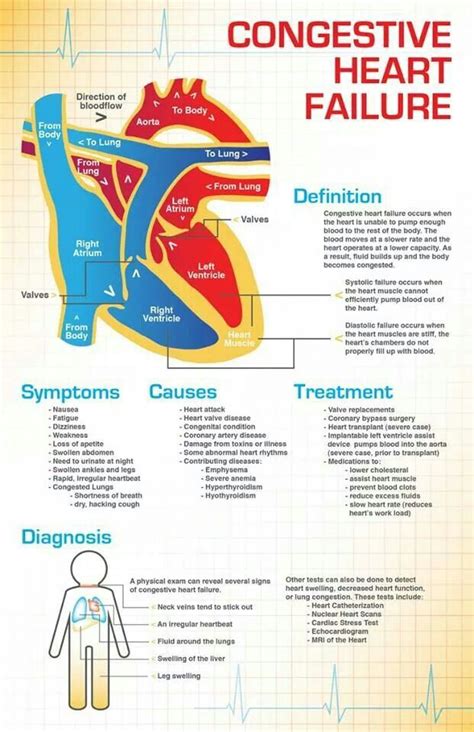 Congestive Heart Failure : Symptoms, Causes, and Treatment