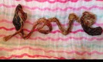 Yes, Umbilical Cord Art Is Really A Thing - Weird But True News