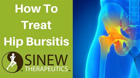 Bursitis Hip Symptoms And Treatment