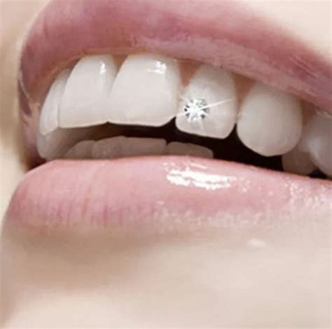 Tooth Diamond Crystal Ornament Teeth Jewelry – LJ Healthcare