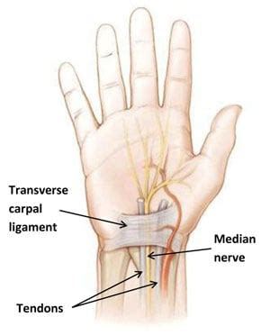 Carpal Tunnel Syndrome: Symptoms, Causes & Treatment