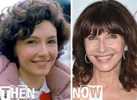 Mary Steenburgen Archives - CELEB-SURGERY.COM