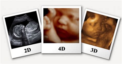 4d Pregnancy Scan - Diagnostics Centre Habra | Diagnostics Centre Ashoknagar | Best Diagnostics ...