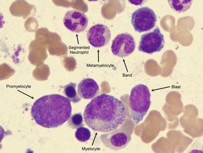 Myelocyte Maturation | Medical laboratory science, Medical laboratory, Clinical chemistry