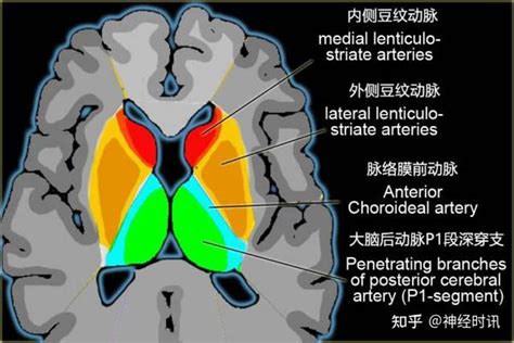 脑动脉供血区域图（高清图谱） - 知乎