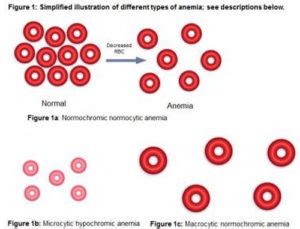 👉 MCHC Blood Test -What does it mean, Normal range (Low, High ...