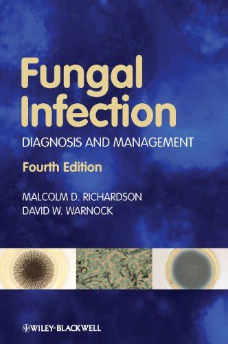 PDF⋙ Fungal Infection: Diagnosis and Management by Malcolm D ...