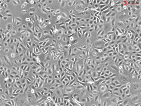 Cryopreserved Human Primary Conjunctival Epithelial Cells, Passage 1